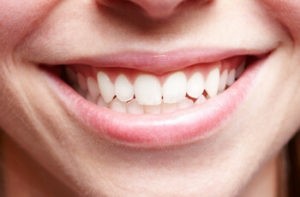 Four Types of Teeth
