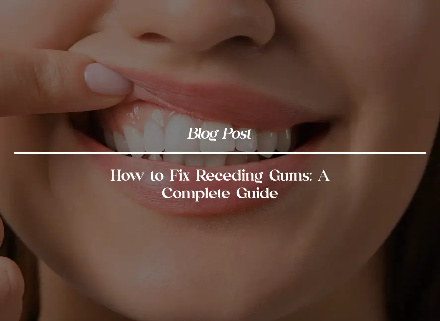 How to Fix Receding Gums: A Complete Guide